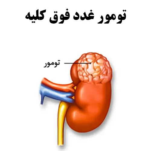 سرطان های ادرنال