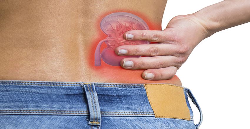 با چه روش هایی سنگ کلیه را دفع کنم؟