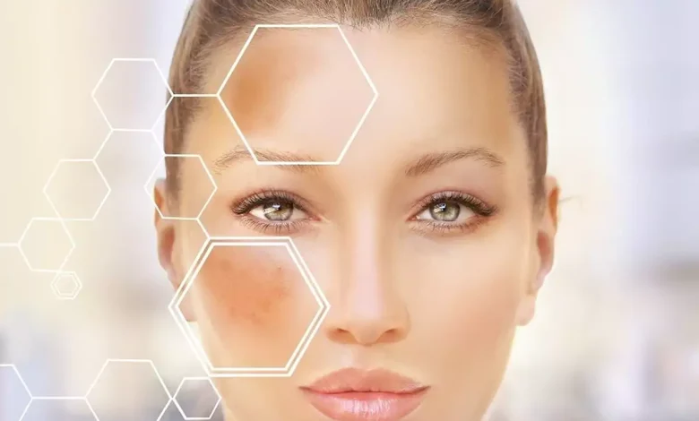 پوست‌تان تیره شده؟ بخوانید!