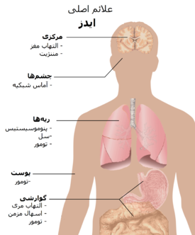 درمان اچ آی وی چیست ؟
