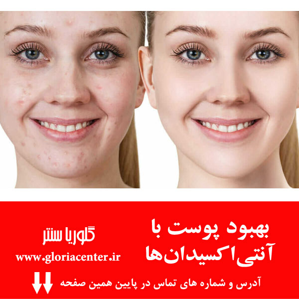 تاثیرات آنتی‌ اکسیدان‌ها بر پوست