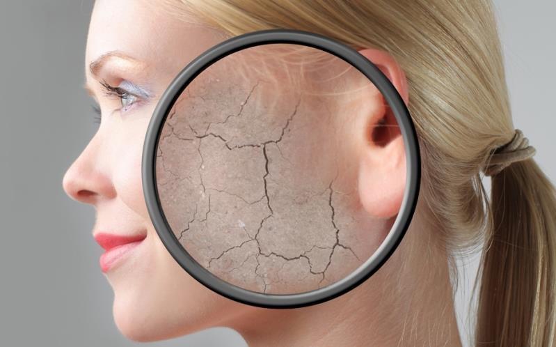 دلیل به وجود آمدن ترک های پوستی و درمان آن چیست ؟