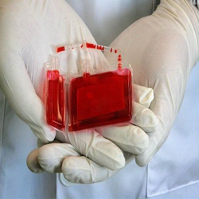 خون بند ناف چیست و چرا آن را ذخیره می کنند ؟
